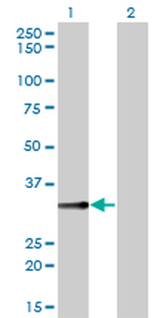 BLVRA monoclonal antibody (M01), clone 4G4-2B6