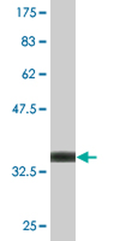 BLMH monoclonal antibody (M02), clone 4A2