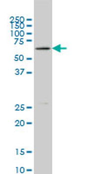 BLK monoclonal antibody (M02), clone 7A12