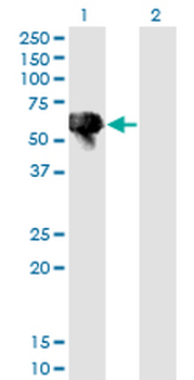 BLK monoclonal antibody (M02), clone 7A12