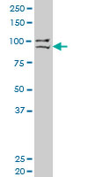 PRDM1 monoclonal antibody (M04), clone 2F8
