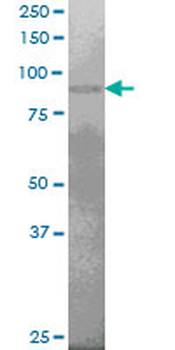 PRDM1 monoclonal antibody (M04), clone 2F8