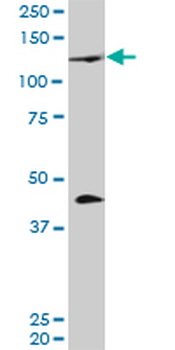PRDM1 monoclonal antibody (M01), clone 2B10