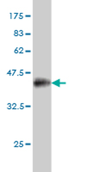 PRDM1 monoclonal antibody (M01), clone 2B10