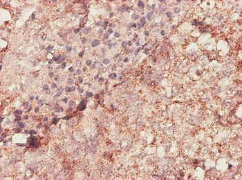 BGN monoclonal antibody (M01), clone 4E1-1G7