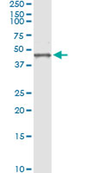 BGN monoclonal antibody (M01), clone 4E1-1G7