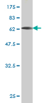 BGN monoclonal antibody (M01), clone 4E1-1G7