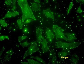 BGLAP monoclonal antibody (M01), clone 2D4