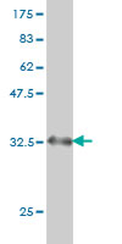 BDKRB2 monoclonal antibody (M01), clone 3F6