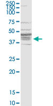 BDKRB1 monoclonal antibody (M04), clone 3A2