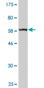 BDH1 monoclonal antibody (M03A), clone 4B3