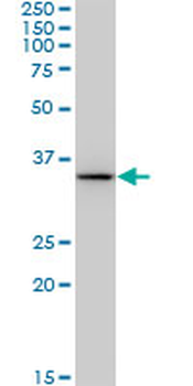 BDH1 monoclonal antibody (M03), clone 4B3