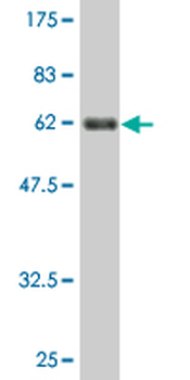 BDH1 monoclonal antibody (M03), clone 4B3