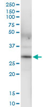 BDH1 MaxPab rabbit polyclonal antibody (D01)
