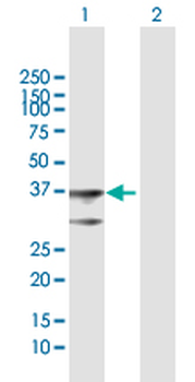 BDH1 MaxPab rabbit polyclonal antibody (D01)