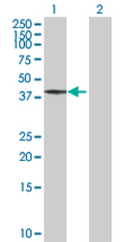 BCS1L purified MaxPab rabbit polyclonal antibody (D01P)
