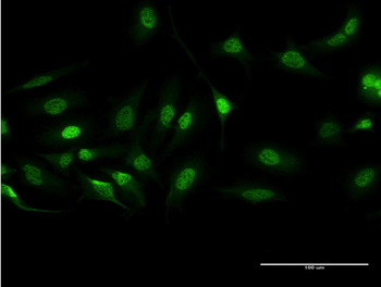 BCR monoclonal antibody (M01), clone 2E5