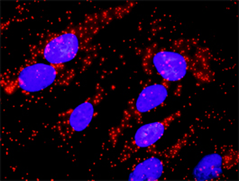 BCR monoclonal antibody (M01), clone 2E5