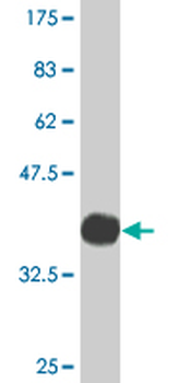 BCR monoclonal antibody (M01), clone 2E5