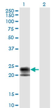 TNFRSF17 monoclonal antibody (M01), clone 1F10