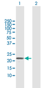 TNFRSF17 MaxPab rabbit polyclonal antibody (D01)