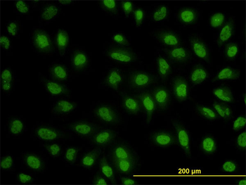 BCL9 monoclonal antibody (M01), clone 2D4