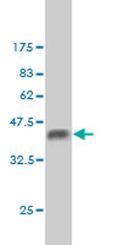 BCL9 monoclonal antibody (M01), clone 2D4