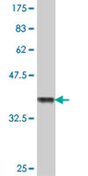 BCKDHA polyclonal antibody (A01)