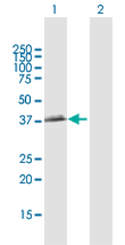 BCAT2 MaxPab rabbit polyclonal antibody (D01)