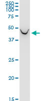 BCAT1 monoclonal antibody (M02), clone 1F8