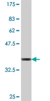 BBS1 polyclonal antibody (A01)