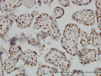 BAX monoclonal antibody (M01), clone 1F5-1B7
