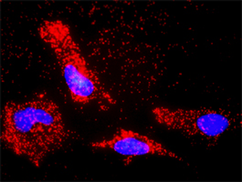 BAX monoclonal antibody (M01), clone 1F5-1B7