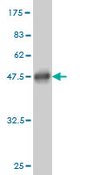 BAX monoclonal antibody (M01), clone 1F5-1B7