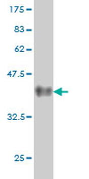 BAG1 monoclonal antibody (M04), clone 4C10