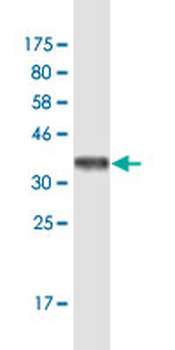 BAG1 monoclonal antibody (M02A), clone 2D3