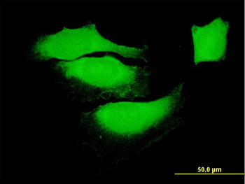 BAG1 monoclonal antibody (M01), clone 4E2