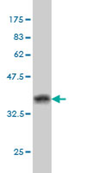 BAG1 monoclonal antibody (M01), clone 4E2