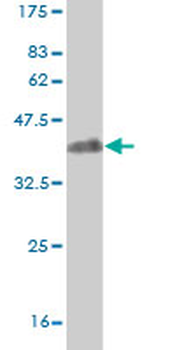 BACH1 monoclonal antibody (M02), clone 1B8