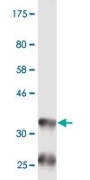BAAT monoclonal antibody (M03), clone 1E4
