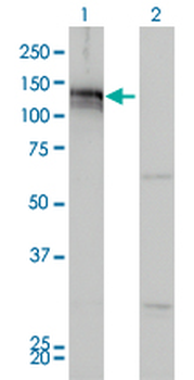 AXL monoclonal antibody (M01), clone 6C8
