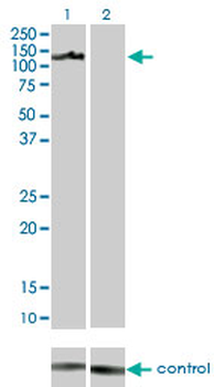 AXL monoclonal antibody (M01), clone 6C8