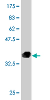 AXL monoclonal antibody (M01), clone 6C8
