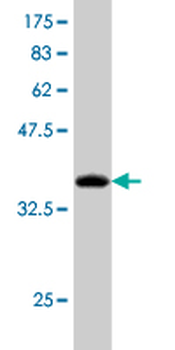 AUH monoclonal antibody (M01), clone 2G12