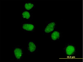 ATR monoclonal antibody (M01), clone 3F2