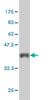 ATR monoclonal antibody (M01), clone 3F2