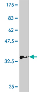 ATP7B monoclonal antibody (M01), clone 3E10