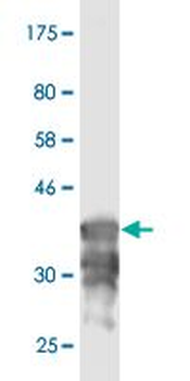 ATP6AP1 monoclonal antibody (M02), clone 3B11