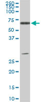 ATP6AP1 monoclonal antibody (M01), clone 3A2