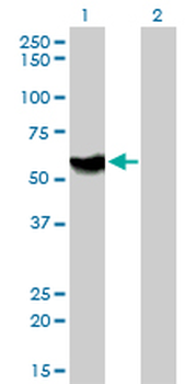 ATP6AP1 monoclonal antibody (M01), clone 3A2